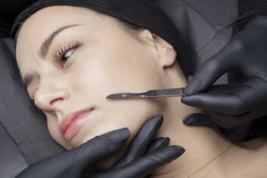 Dermaplaning Naperville