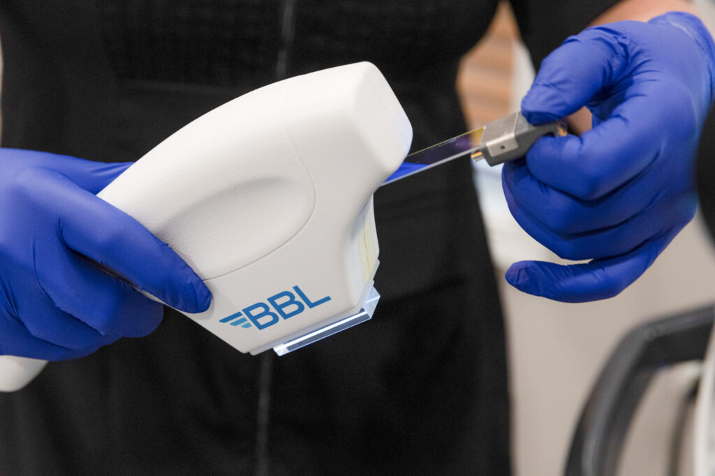 BBL® HERO™ Photofacial