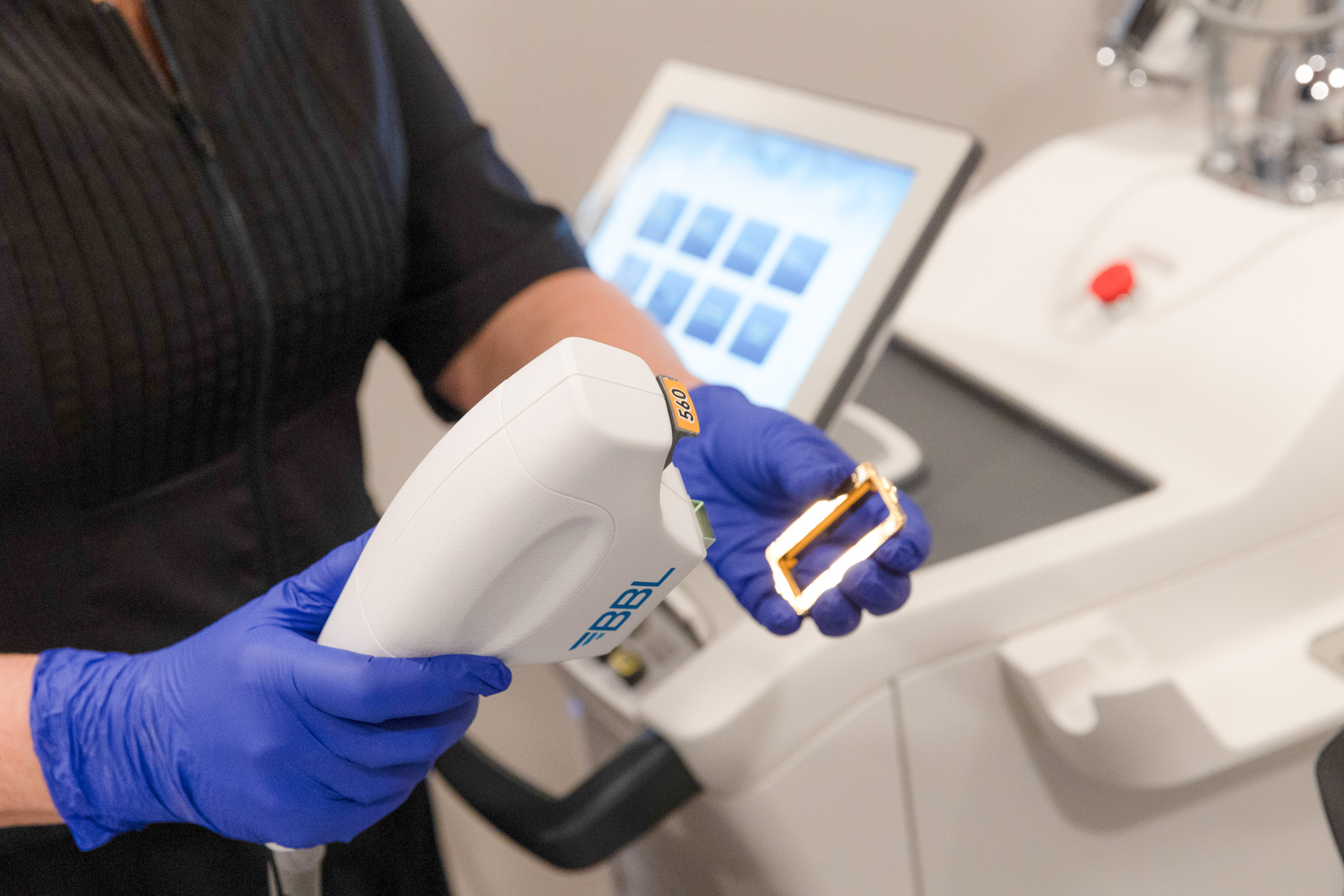 Provider assessing facial redness during a rosacea consultation at SMooth Solutions Medspa in Naperville