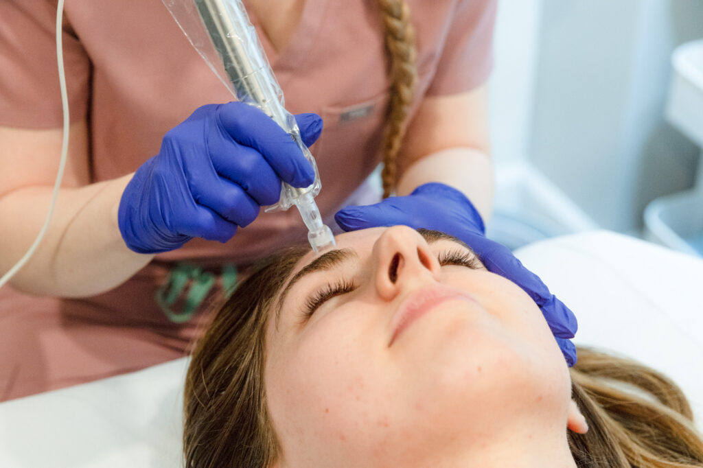 Microneedling