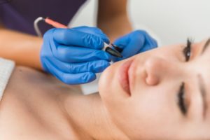 laser hair removal patient