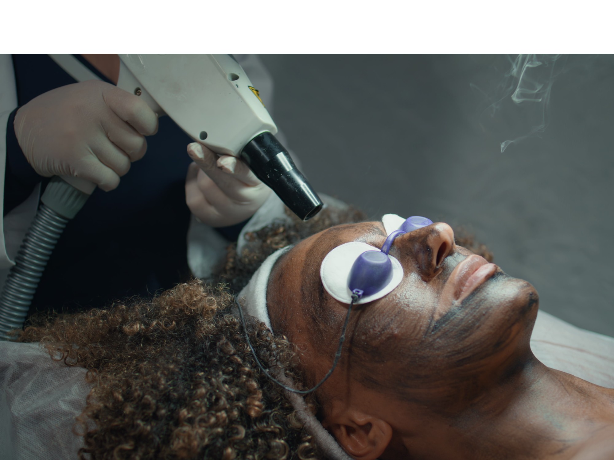 BBL Photofacial