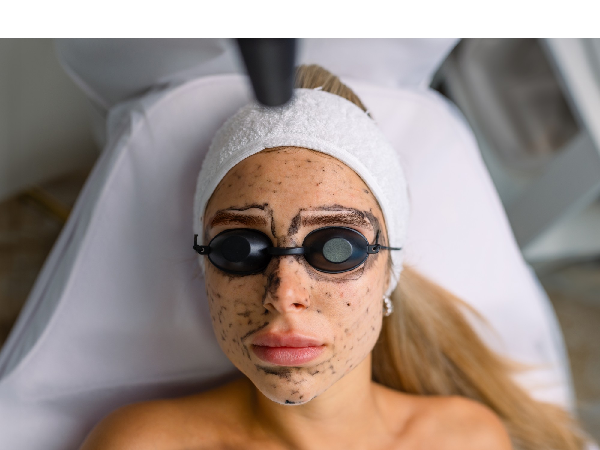 BBL Photofacial