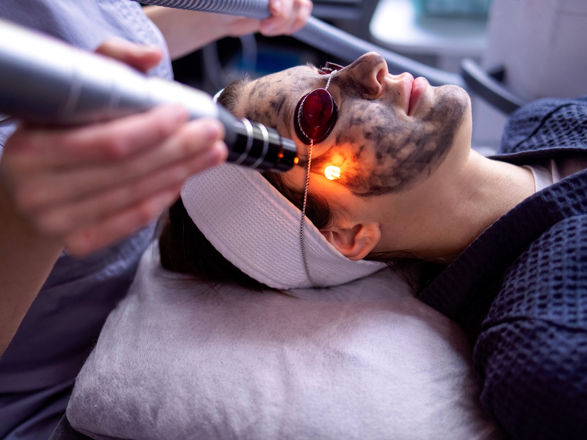 CO2 Laser Resurfacing
