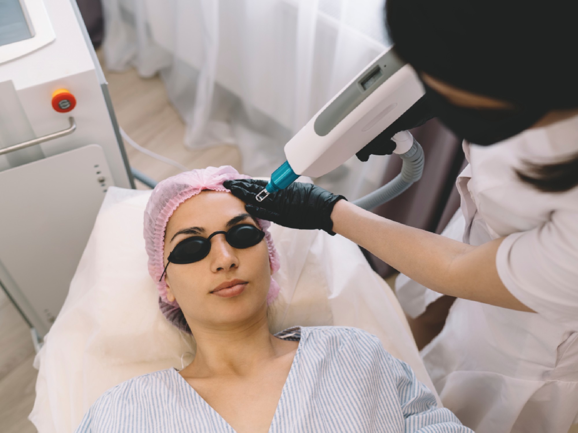 CO2 Laser Resurfacing