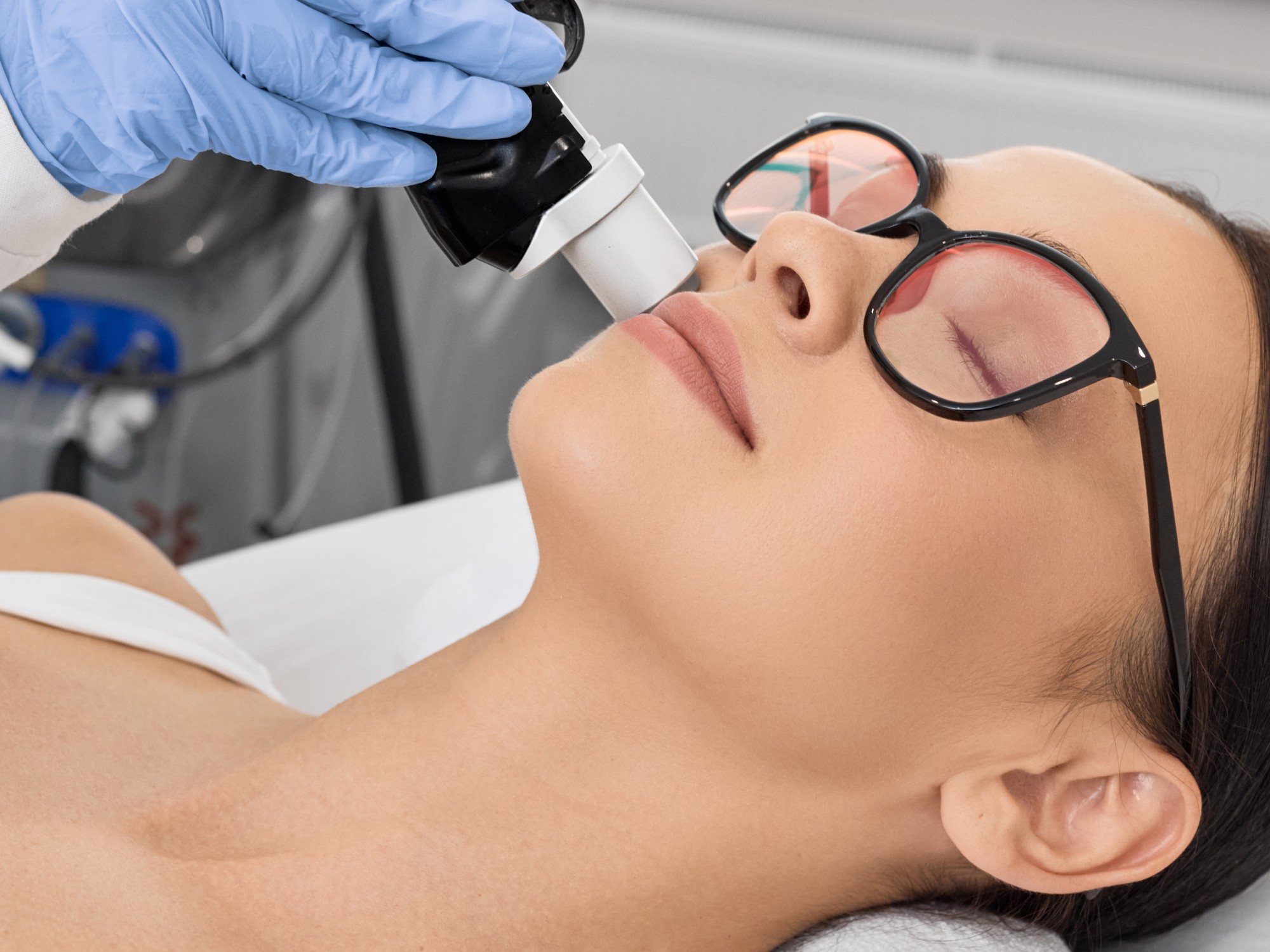 ERBIUM YAG LASER RESURFACING
