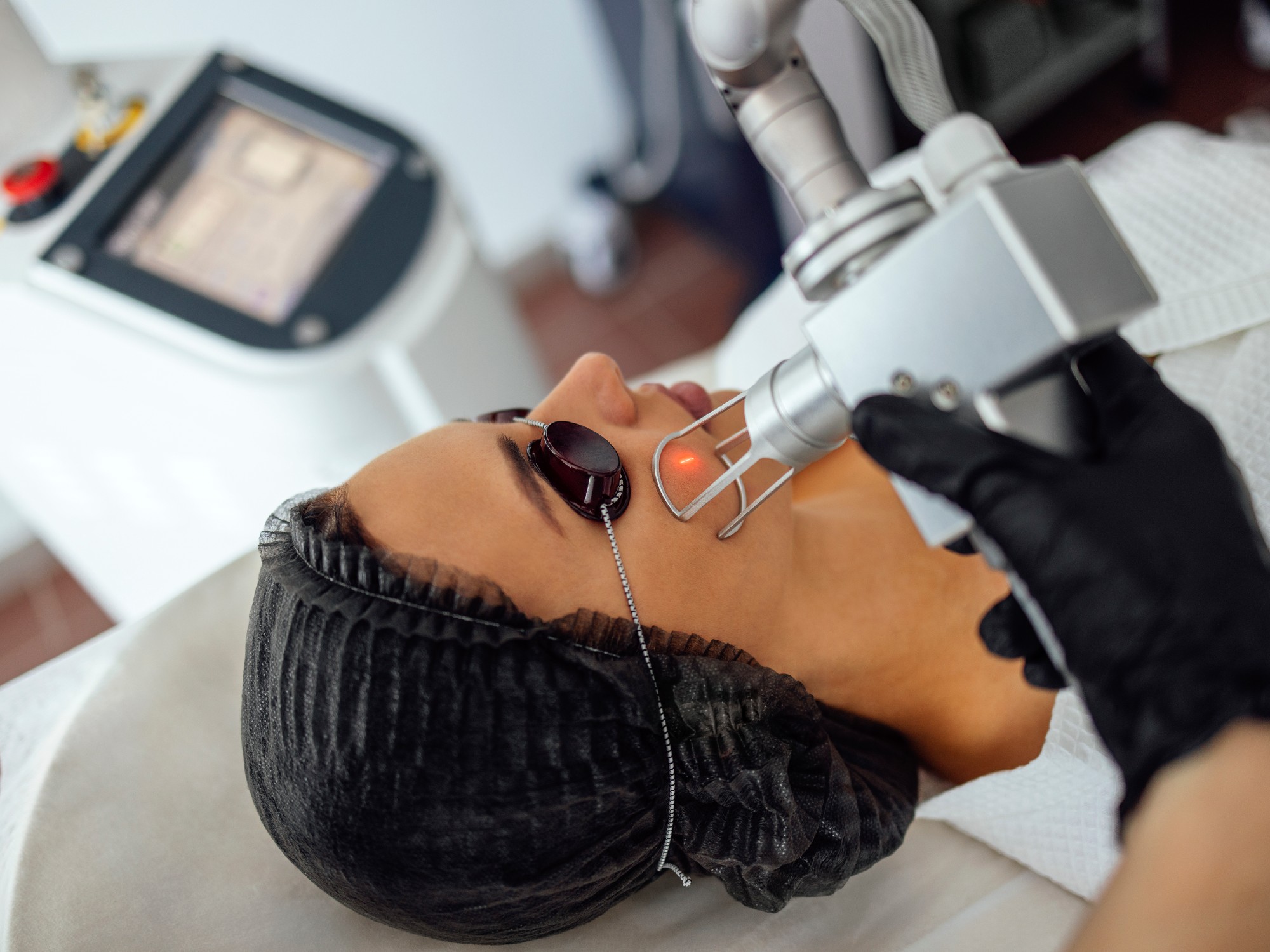 ERBIUM YAG LASER RESURFACING