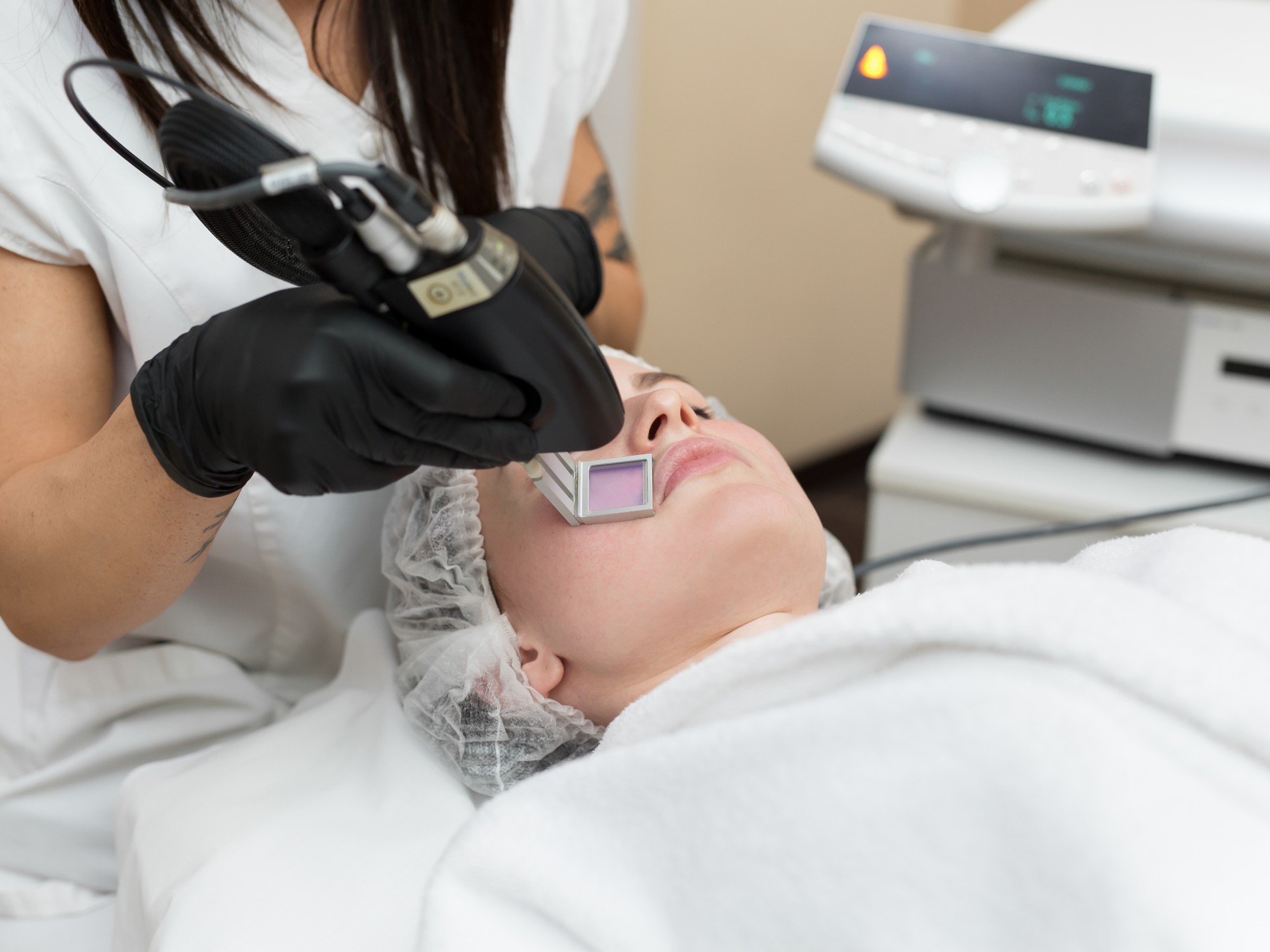 ERBIUM YAG LASER RESURFACING