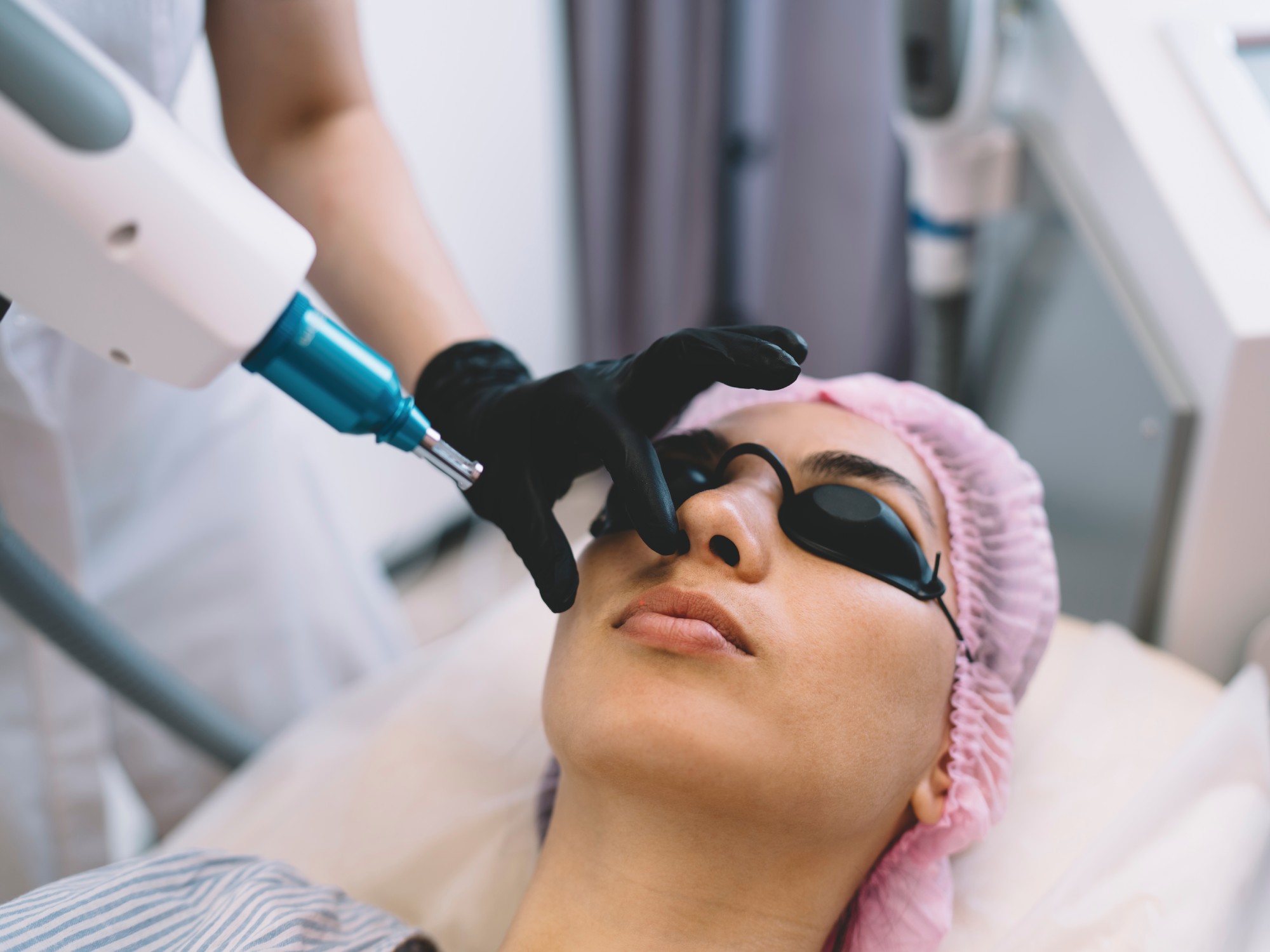 HALO Laser Resurfacing