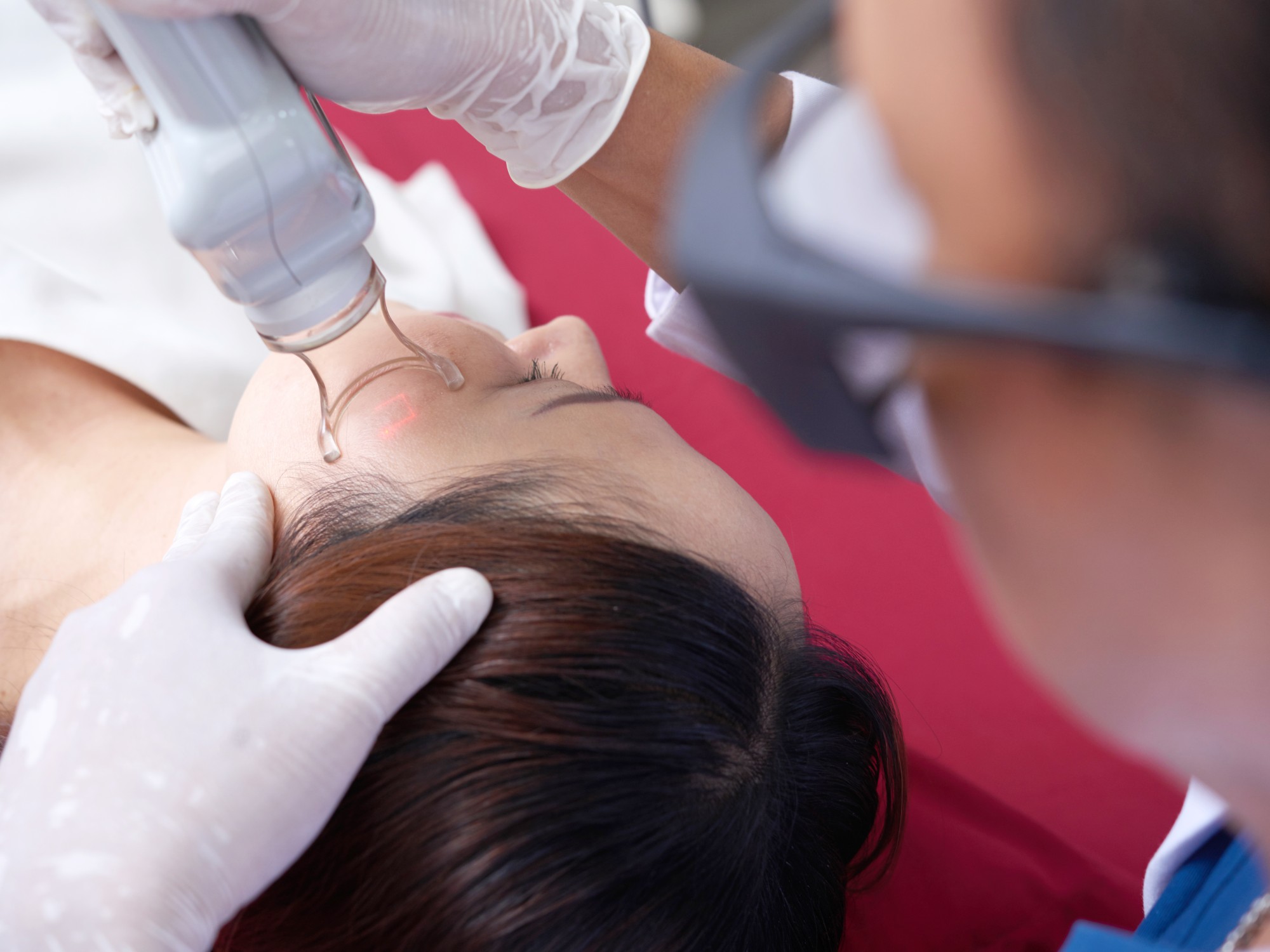 HALO Laser Resurfacing