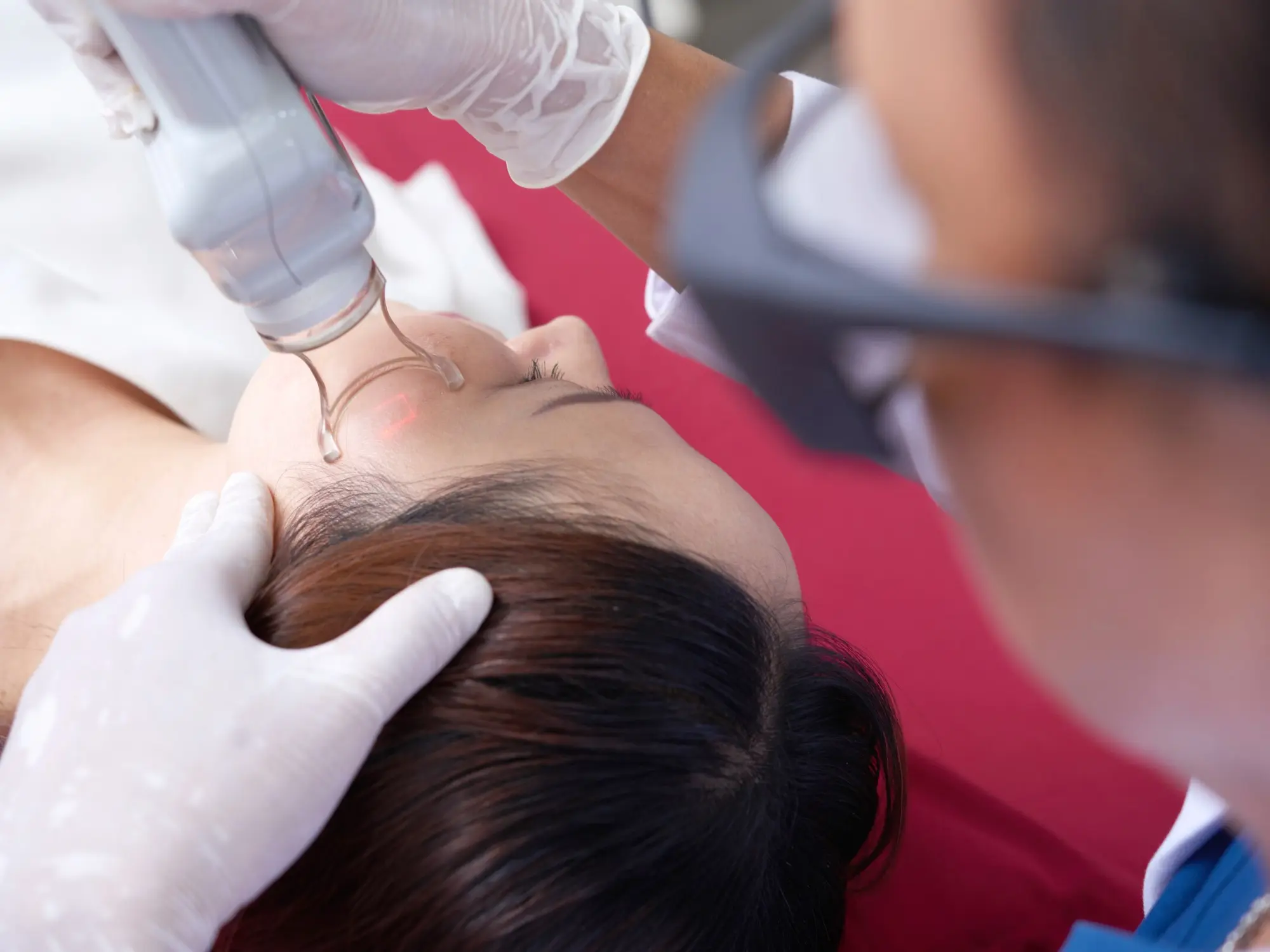 HALO Laser Resurfacing