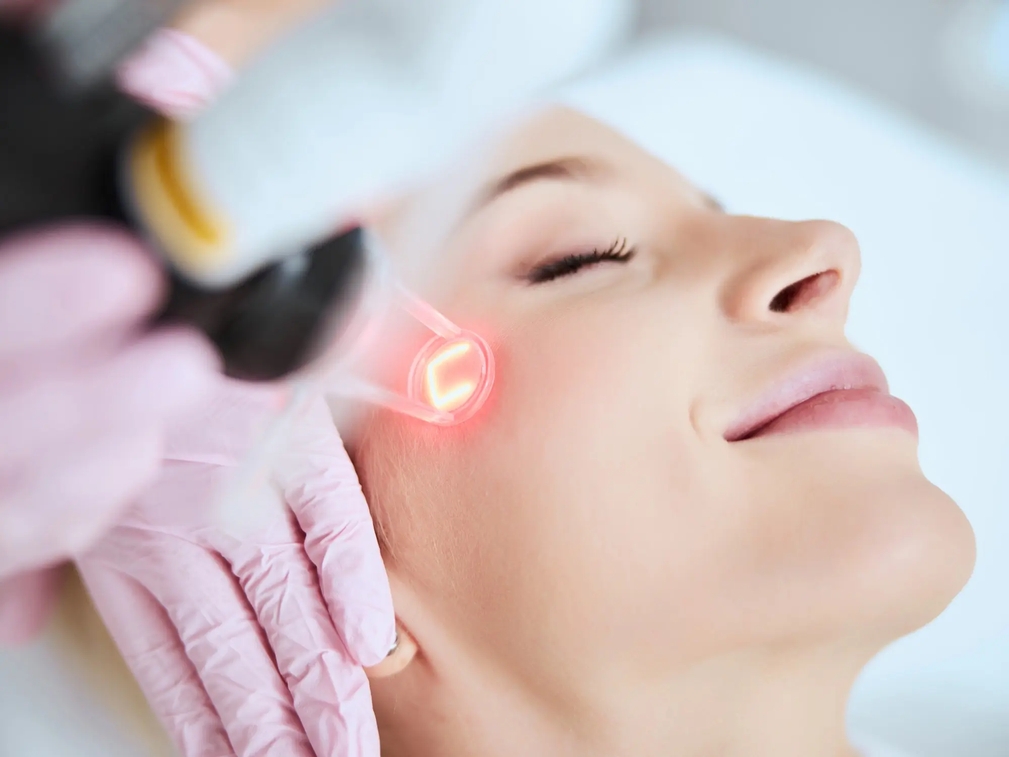 HALO Laser Resurfacing