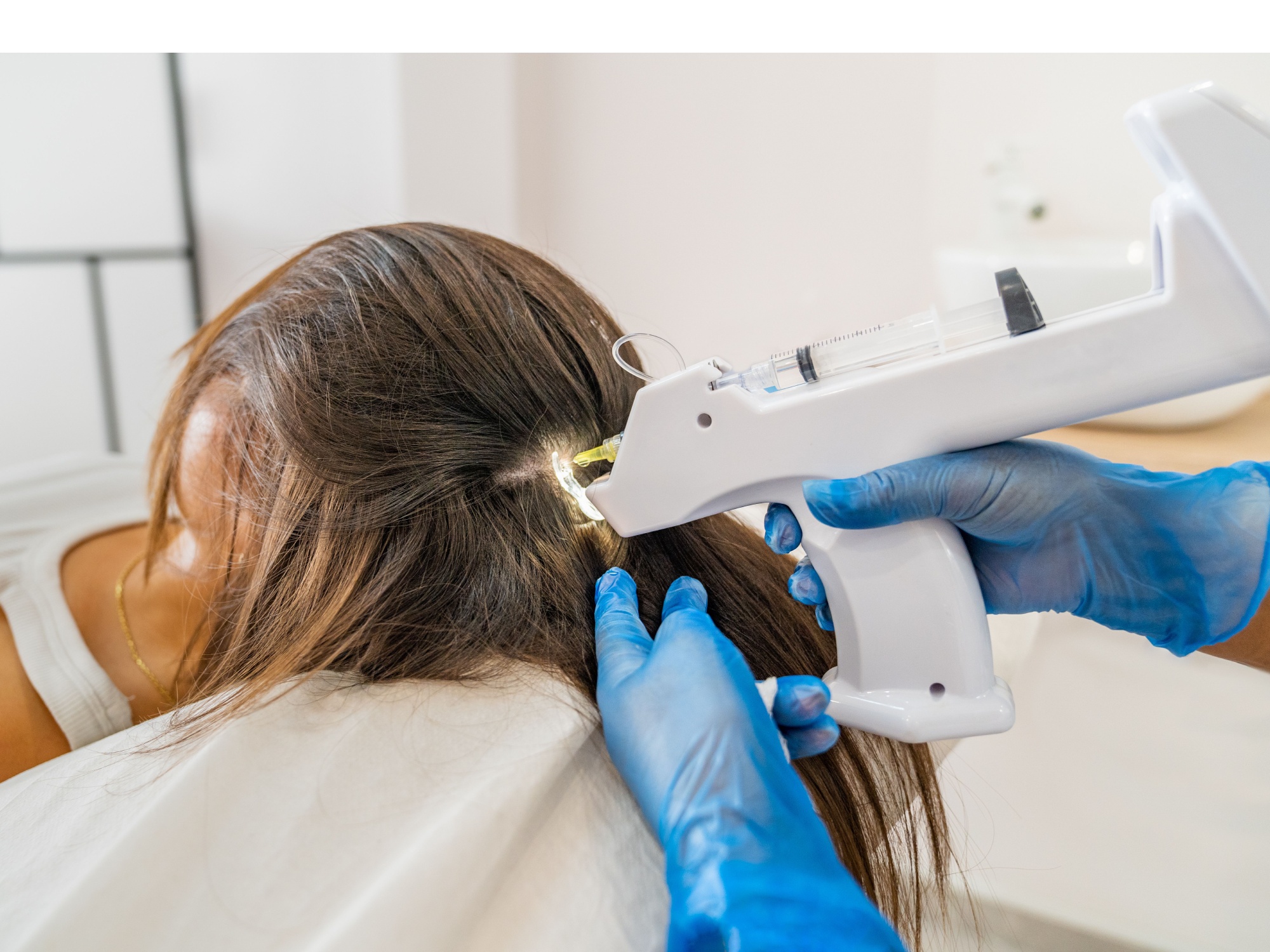 KeraLase Hair Restoration