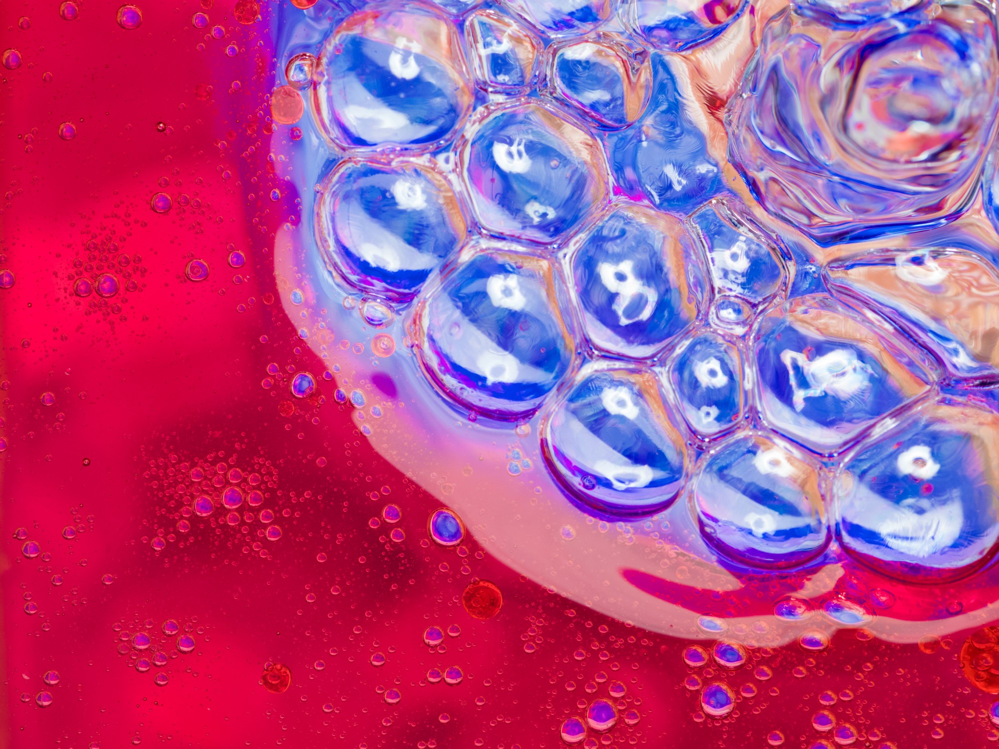Microneedling with Exosomes