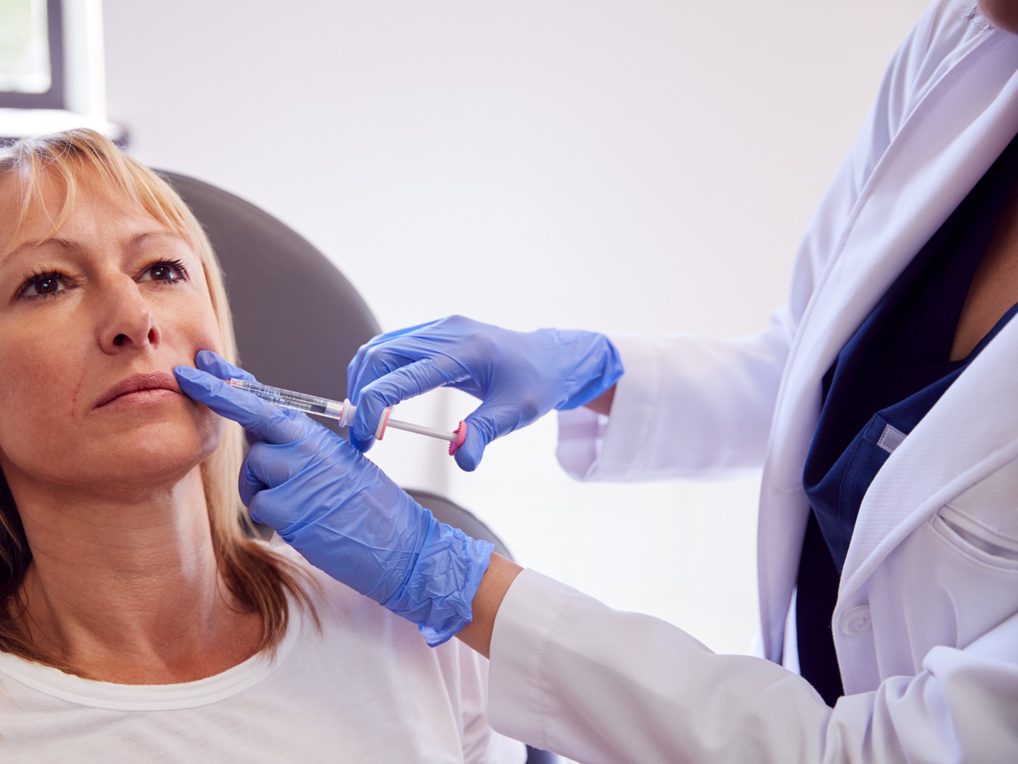 Sculptra and Radiesse Biostimulators