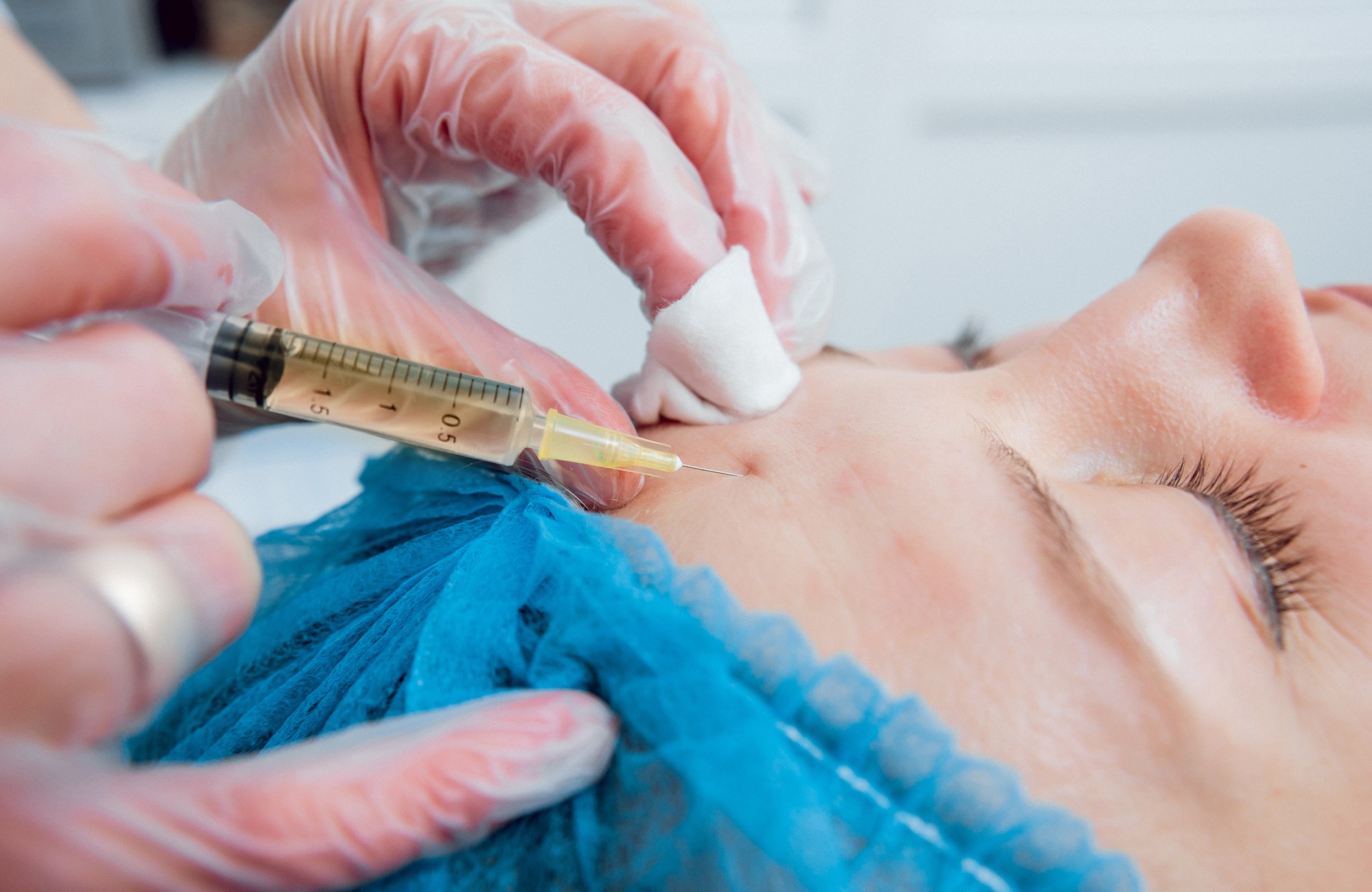 Depigmentation Mesotherapy