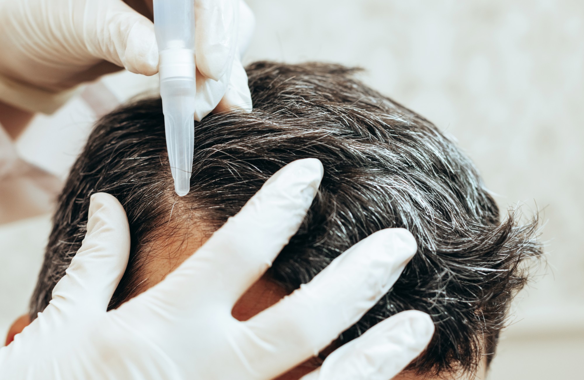Scalp Booster