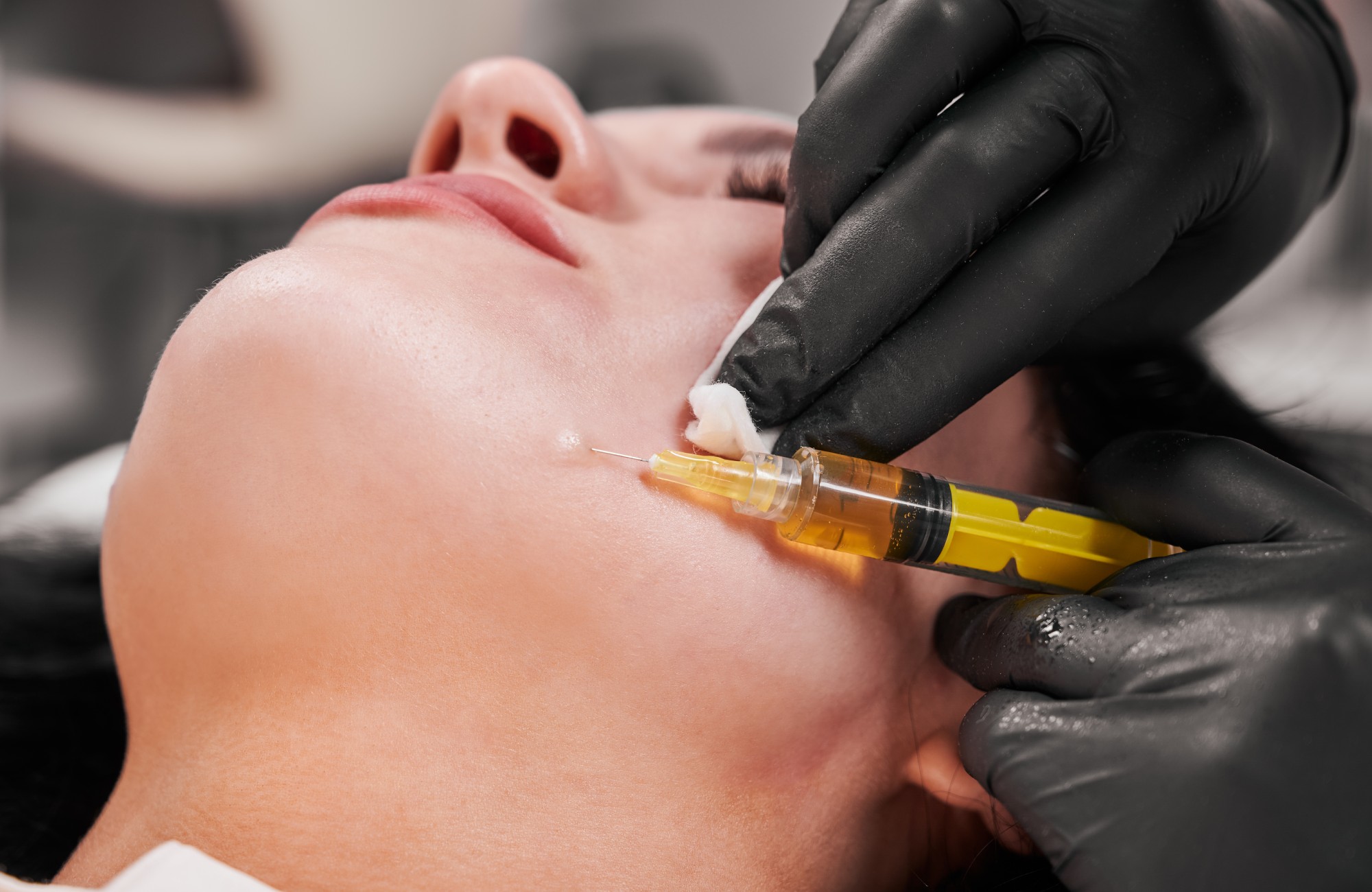 Vitamin C Mesotherapy