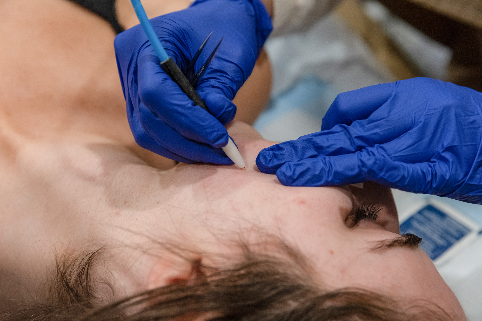 Electrolysis